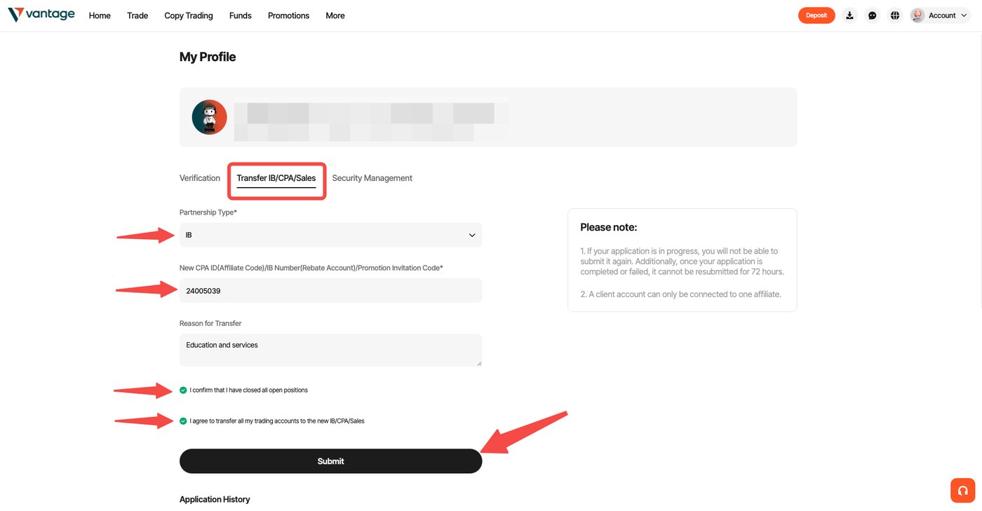 Le formulaire de transfert Vantage, avec le code et les deux confirmations à cocher